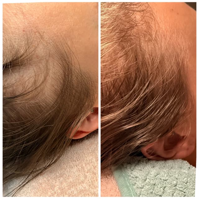 The Fuller Journey Series of 6 at The Skin Bungalow Aesthetic Studio in Arvada, CO